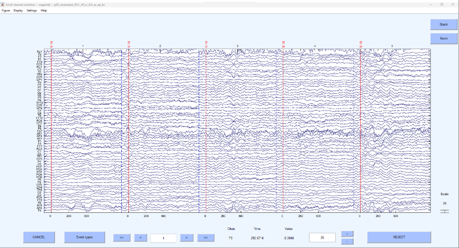 EEG Analysis - Segmentation