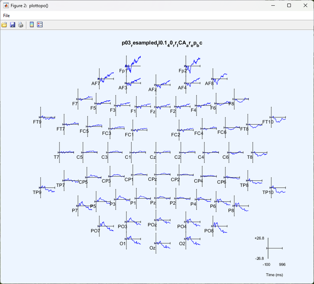 EEG Analysis - Segmentation